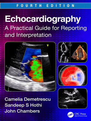 cover image of Echocardiography